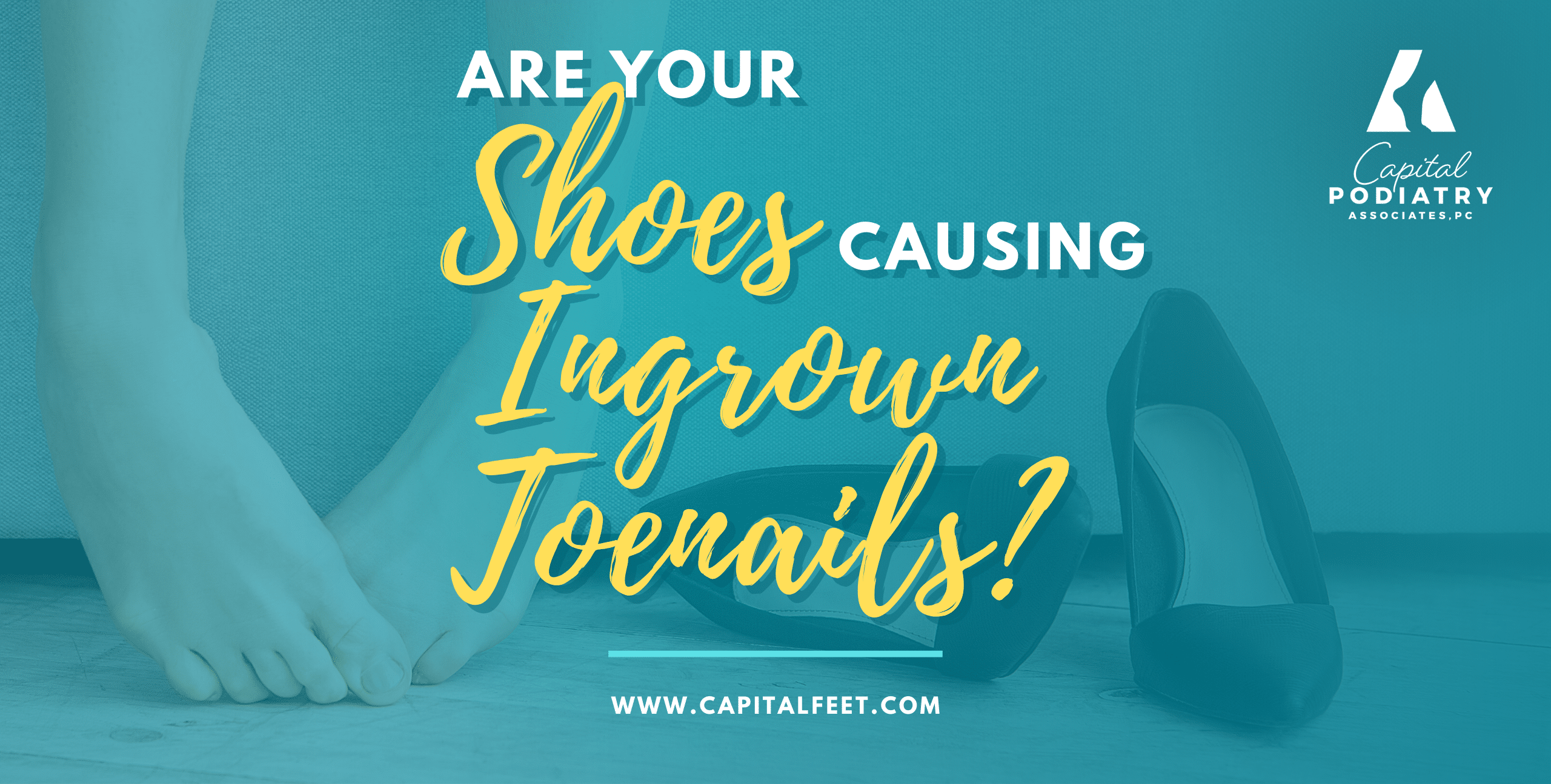 Are your shoes causing ingrown toenails?