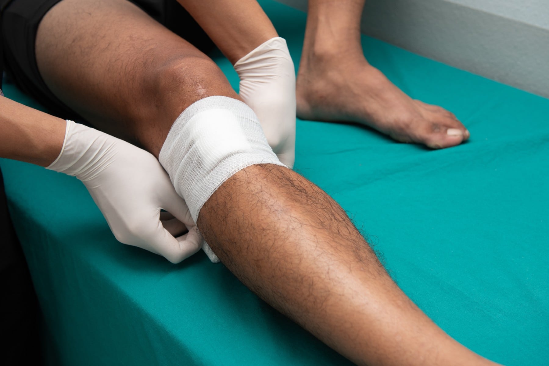 a wound on a man's leg getting wrapped in gauze